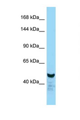 NFATC2 antibody LS-C146525 Western blot of Mouse Liver lysate. Antibody concentration 1 ug/ml.