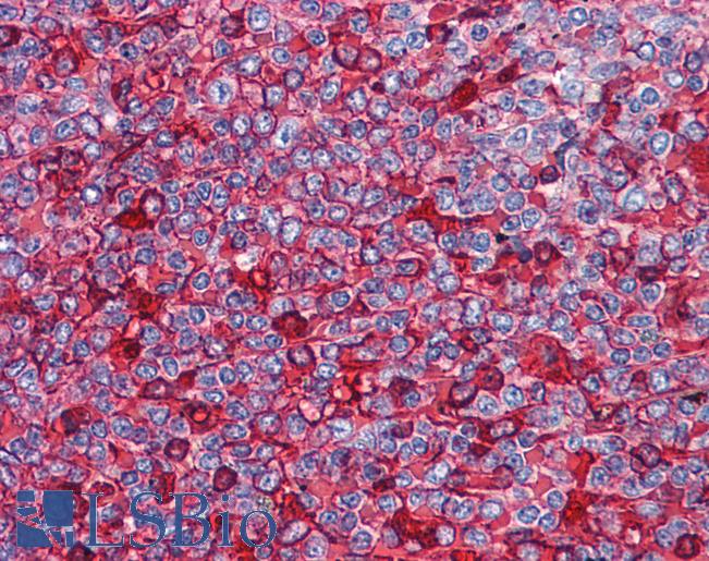 Anti-NFATC2 antibody IHC of human spleen. Immunohistochemistry of formalin-fixed, paraffin-embedded tissue after heat-induced antigen retrieval. Antibody LS-B4464 concentration 3.75 ug/ml.