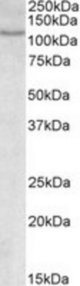 NFATC2 antibody (0.3 ug/ml) staining of MOLT4 lysate (35 ug protein in RIPA buffer). Primary incubation was 1 hour. Detected by chemiluminescence.