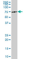 ME1 monoclonal antibody (M03), clone 3H5. Western blot of ME1 expression in HepG2.