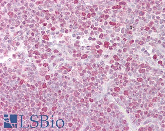 Anti-NFATC2 antibody IHC of human thymus. Immunohistochemistry of formalin-fixed, paraffin-embedded tissue after heat-induced antigen retrieval. Antibody LS-B6809 concentration 5 ug/ml.