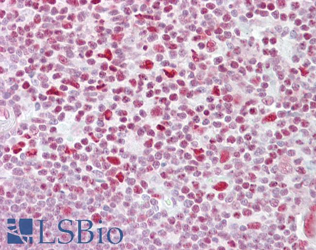 Anti-NFATC3 antibody IHC of human thymus. Immunohistochemistry of formalin-fixed, paraffin-embedded tissue after heat-induced antigen retrieval. Antibody LS-B6971 concentration 5 ug/ml.