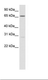 SP2/0 Cell Lysate
