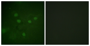Immunofluorescence of COS7 cells, using NFAT5 (Phospho-Ser1197) Antibody. The sample on the right was incubated with synthetic peptide.