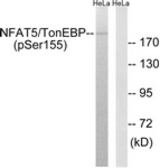 Western blot of extracts from HeLa cells treated with forskolin 40nM 30', using NFAT5/TonEBP (Phospho-Ser155) Antibody. The lane on the right was incubated with synthetic peptide.