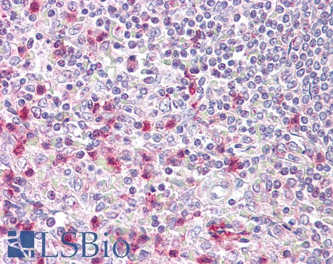 Anti-NFAT5 antibody IHC of human spleen. Immunohistochemistry of formalin-fixed, paraffin-embedded tissue after heat-induced antigen retrieval. Antibody LS-B7553 concentration 10 ug/ml.
