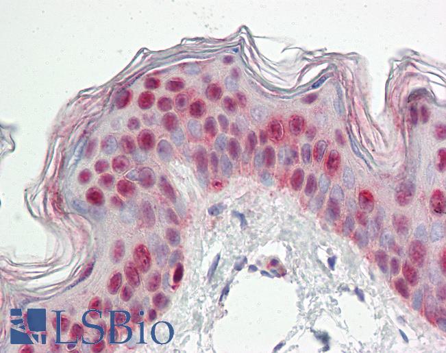 Human Skin: Formalin-Fixed, Paraffin-Embedded (FFPE)