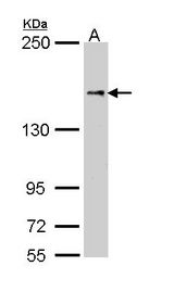 Sample (30 ug of whole cell lysate). A: Molt-4. 5% SDS PAGE. NFAT5 antibody diluted at 1:1000.