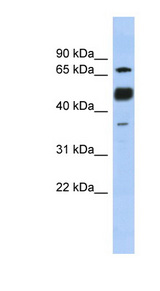 NFATC1 antibody LS-C112376 Western blot of Fetal Stomach lysate.