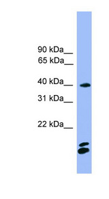NFATC1 antibody LS-C116876 Western blot of Fetal Brain lysate.