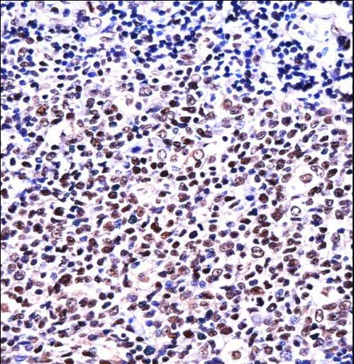 NFATC1 Antibody immunohistochemistry of formalin-fixed and paraffin-embedded human tonsil tissue followed by peroxidase-conjugated secondary antibody and DAB staining.