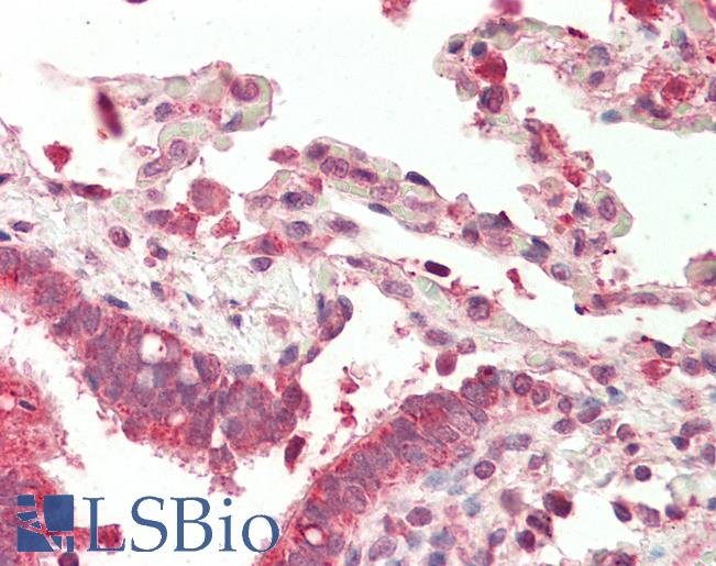 Human, Lung: Foramlin-Fixed Paraffin-Embedded (FFPE)