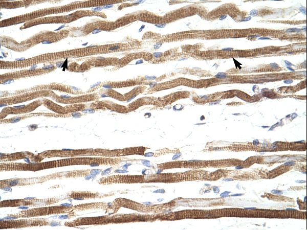 NFATC4 antibody LS-C31452 was used in IHC to stain formalin-fixed, paraffin-embedded human muscle.
