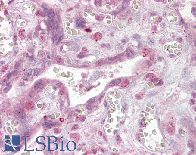 Anti-NFATC4 antibody IHC of human placenta. Immunohistochemistry of formalin-fixed, paraffin-embedded tissue after heat-induced antigen retrieval. Antibody LS-B6449 concentration 2.5 ug/ml.