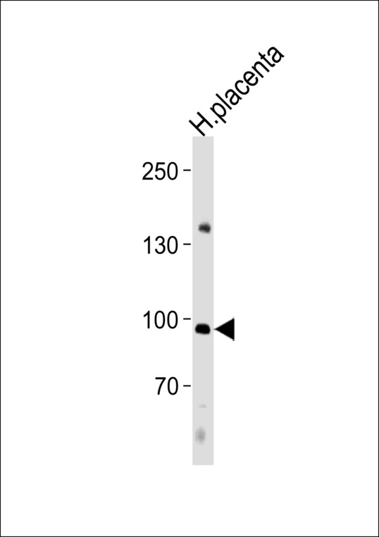 NFATC4 Antibody western blot of human placenta tissue lysates (35 ug/lane). The NFATC4 antibody detected the NFATC4 protein (arrow).