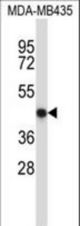NFE2 Antibody western blot of MDA-MB435 cell line lysates (35 ug/lane). The NFE2 antibody detected the NFE2 protein (arrow).