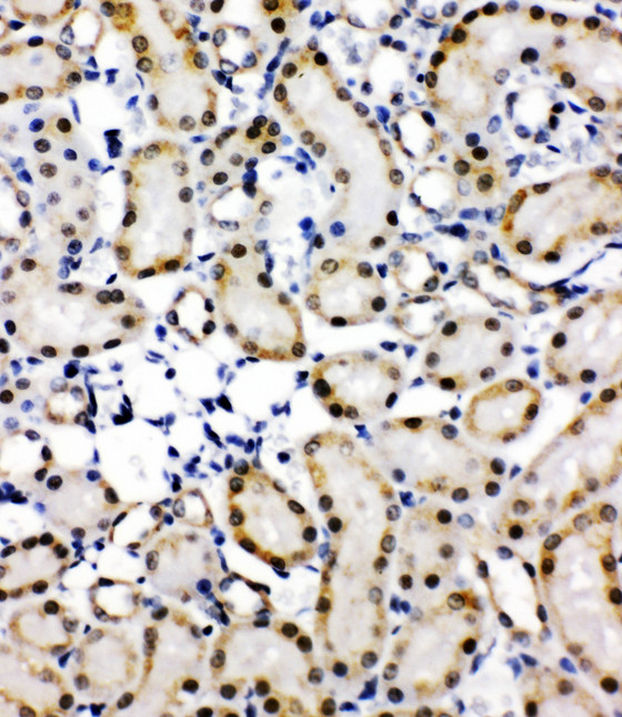 NFE2L2 / NRF2 antibody. IHC(P): Rat Kidney Tissue.