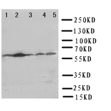 WB of NFE2L2 / NRF2 antibody. Lane 1: JURKAT Cell Lysate. Lane 2: HELA Cell Lysate. Lane 3: A549 Cell Lysate. Lane 4: SMMC Cell Lysate. Lane 5: M231 Cell Lysate.