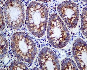 IHC of paraffin-embedded human colon tissue using anti-ME2 antibody.
