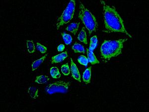 Immunofluorescent staining of HeLa cells using anti-ME2 antibody.