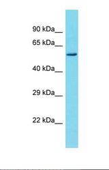 Western blot of Human Uterus Tumor. NFIC antibody dilution 1.0 ug/ml.