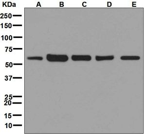Western blot analysis on (A) 293T, (B) Jurkat, (C) HeLa, (D) K562, and (E) Molt-4 cell lysates using anti-ME2 antibody.