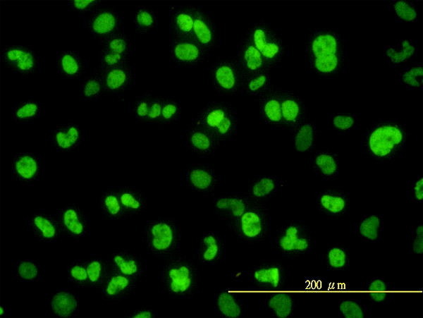 Immunofluorescence of monoclonal antibody to NFIC on HeLa cell. [antibody concentration 10 ug/ml]