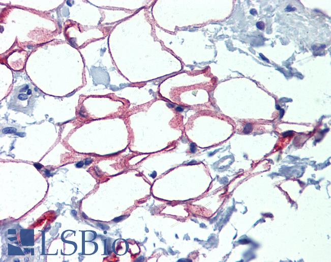 Anti-NFIC antibody IHC of normal human adrenal (adipocytes). Immunohistochemistry of formalin-fixed, paraffin-embedded tissue after heat-induced antigen retrieval. Antibody LS-B4029 concentration 5 ug/ml.