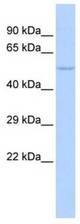 Western analysis of MCF7 cell lysate.