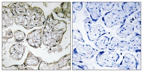 IHC of paraffin-embedded human placenta tissue, using ME2 Antibody. The sample on the right was incubated with synthetic peptide.
