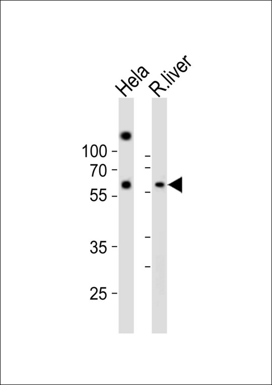 Western blot of lysates from HeLa cell line, rat liver tissue lysate (from left to right) with NFIA Antibody. Antibody was diluted at 1:1000 at each lane. A goat anti-rabbit IgG H&L (HRP) at 1:10000 dilution was used as the secondary antibody. Lysates at 20 ug per lane.