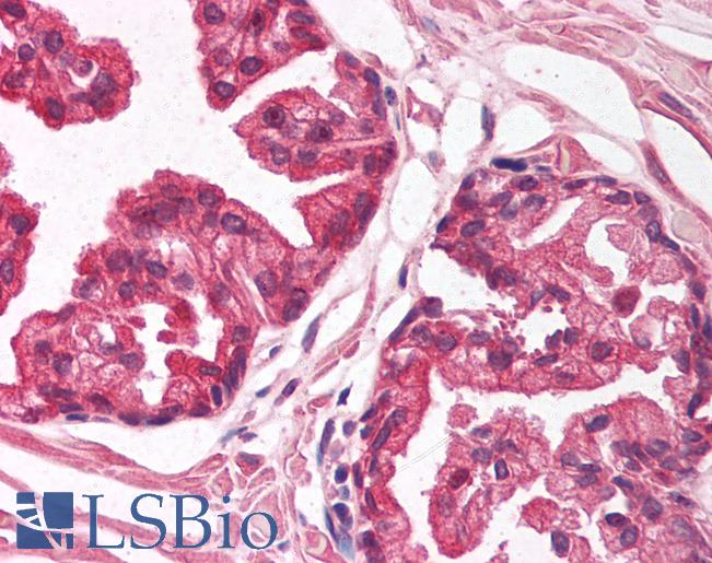 Anti-NFIA antibody IHC of human prostate. Immunohistochemistry of formalin-fixed, paraffin-embedded tissue after heat-induced antigen retrieval. Antibody LS-B1549 concentration 5 ug/ml.