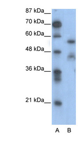 NFIA antibody LS-B1549 Western blot of Jurkat lysate.