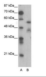 A: Marker, B: Jurkat Cell Lysate