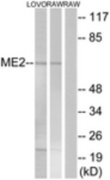 Western blot of extracts from RAW264.7/LOVO cells, using ME2 Antibody. The lane on the right was incubated with synthetic peptide.