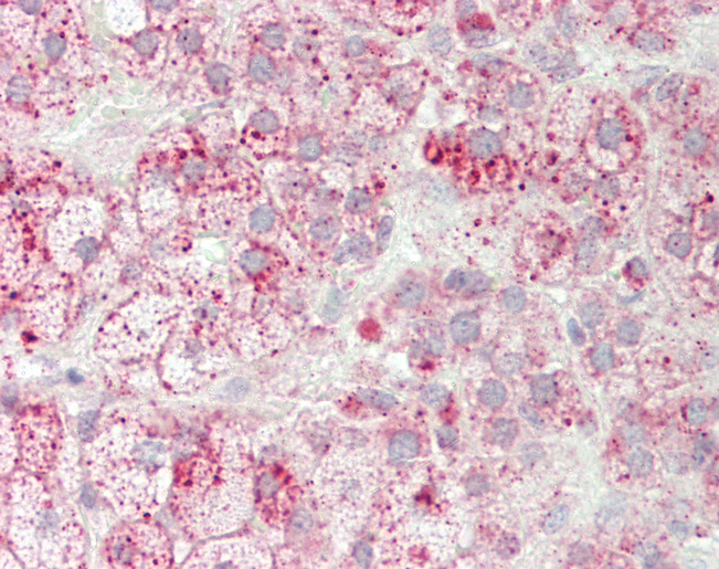 Human Adrenal: Formalin-Fixed, Paraffin-Embedded (FFPE)