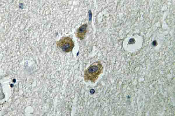 IHC of ME3 (R576) pAb in paraffin-embedded human brain tissue.