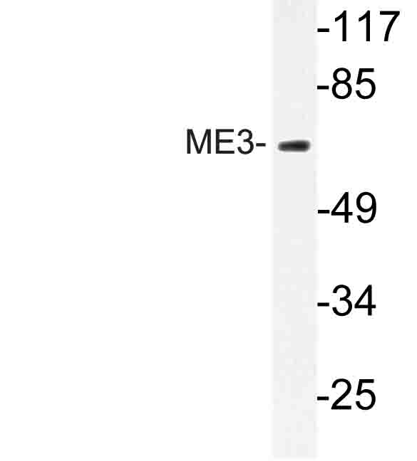 Western blot of ME3 (R576) pAb in extracts from RAW264 cells.
