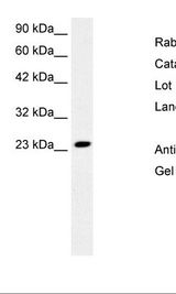 Jurkat Cell Lysate