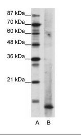 A: Marker, B: Rap Cell Lysate