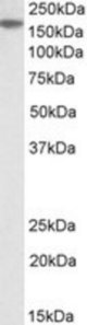 MECOM antibody (2 ug/ml) staining of A549 lysate (35 ug protein/ml in RIPA buffer). Primary incubation was 1 hour. Detected by chemiluminescence.
