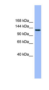 MECOM antibody LS-C116794 Western blot of Fetal Kidney lysate.