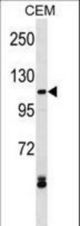 EVI1 Antibody western blot of CEM cell line lysates (35 ug/lane). The EVI1 antibody detected the EVI1 protein (arrow).