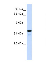 NFKBIA antibody LS-C112311 Western blot of 293T Cell lysate. Antibody concentration 1 ug/ml.