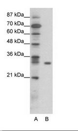 A: Marker, B: Jurkat Cell Lysate
