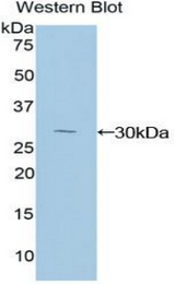 Western blot of recombinant NFKBID / IkappaBNS.