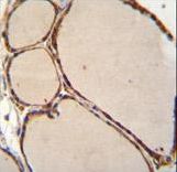 NFKBID Antibody immunohistochemistry of formalin-fixed and paraffin-embedded human thyroid tissue followed by peroxidase-conjugated secondary antibody and DAB staining.