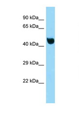 NFKBIL1 antibody LS-C146400 Western blot of Mouse Liver lysate. Antibody concentration 1 ug/ml.