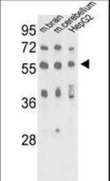 Western blot of MeCP2-S421* in mouse brain, cerebellum tissue and HepG2 cell line lysates (35 ug/lane). CP2 (arrow) was detected using the purified antibody.
