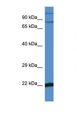 NFKBIZ antibody LS-C135459 Western blot of Mouse Brain lysate. Antibody concentration 1 ug/ml.